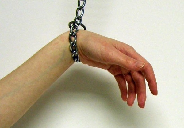 Sindrome della mano aliena